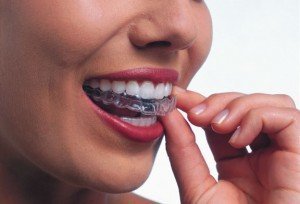 About Invisalign®