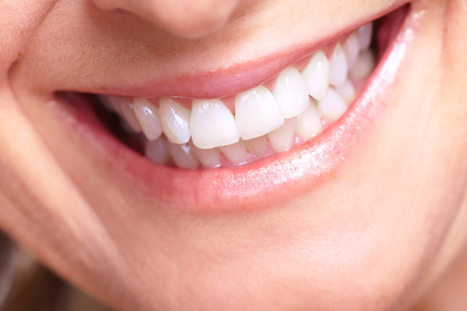 Cosmetic Dentistry Options for Chipped Teeth