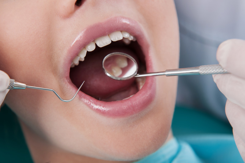 How to Prevent Needing a Root Canal in Alpharetta