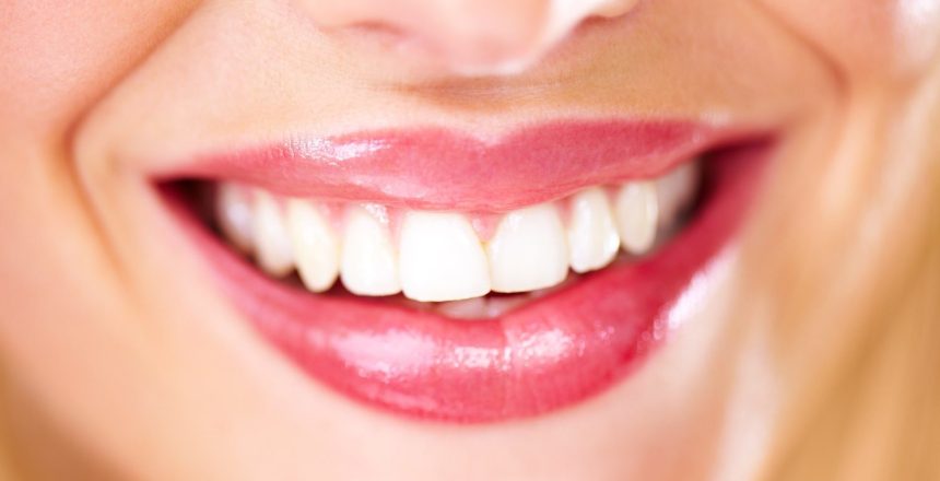 different types of staining tooth whitening can help
