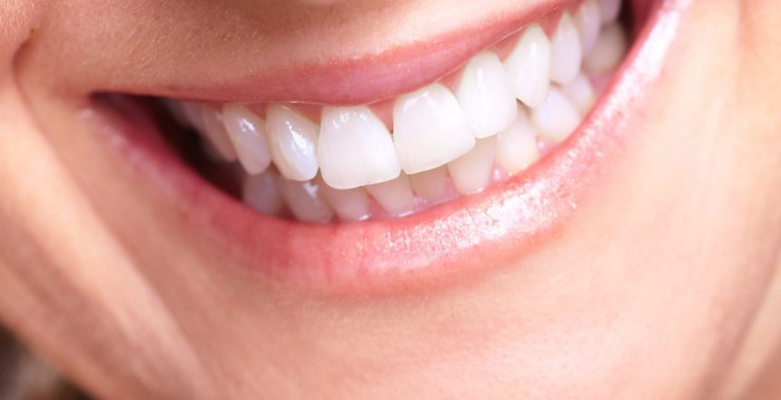 cosmetic dentistry options for chipped teeth
