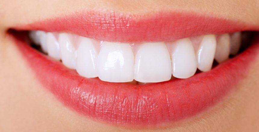 facts about Invisalign